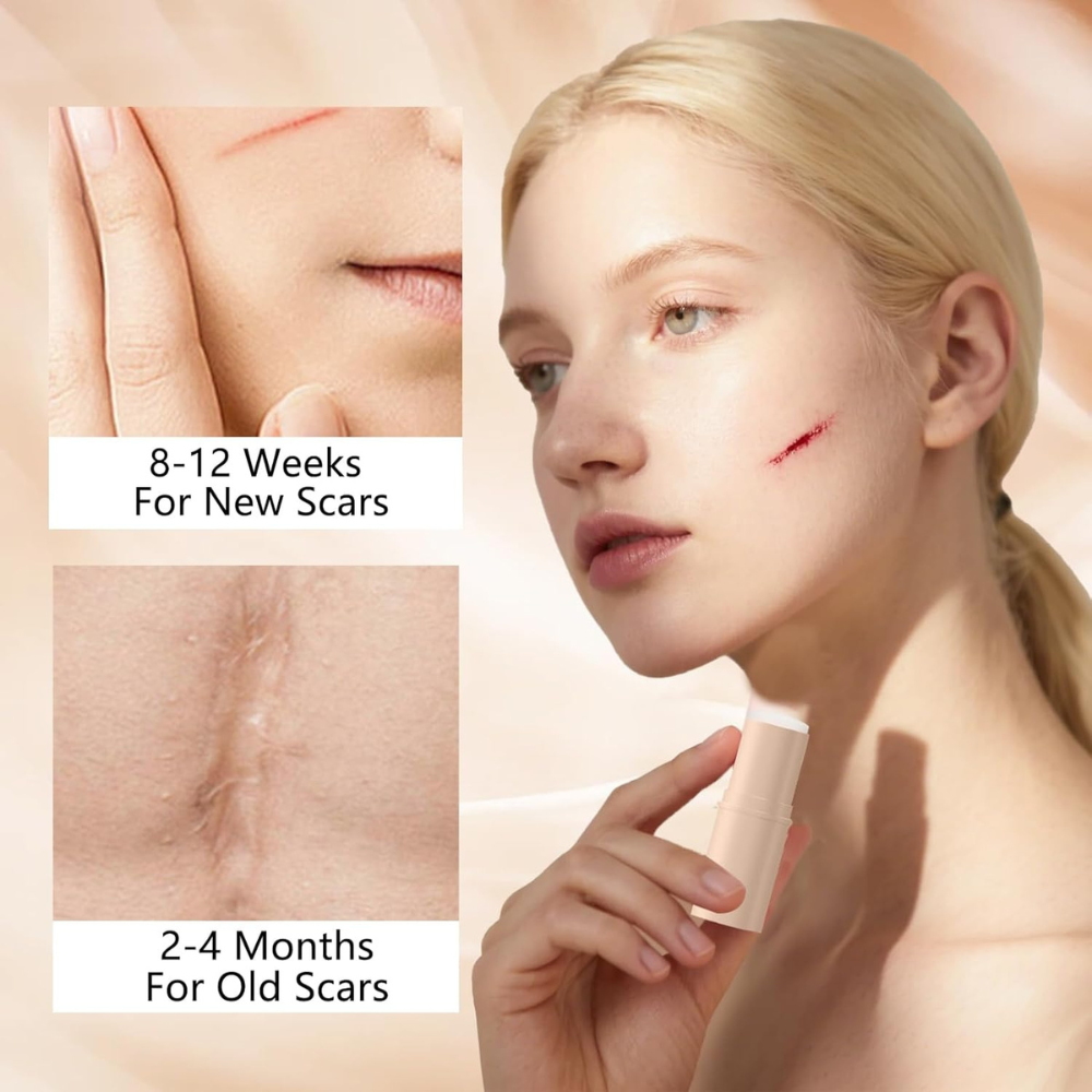 Silicone Scar Stick