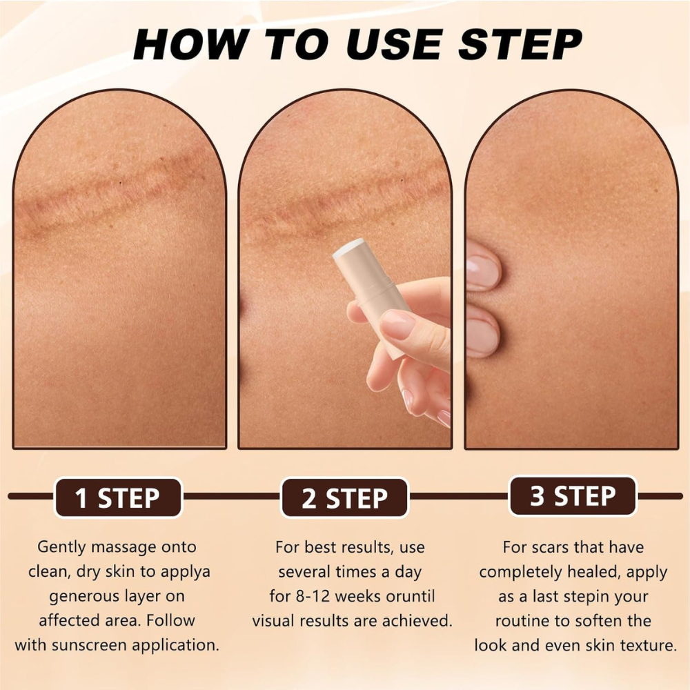 Silicone Scar Stick